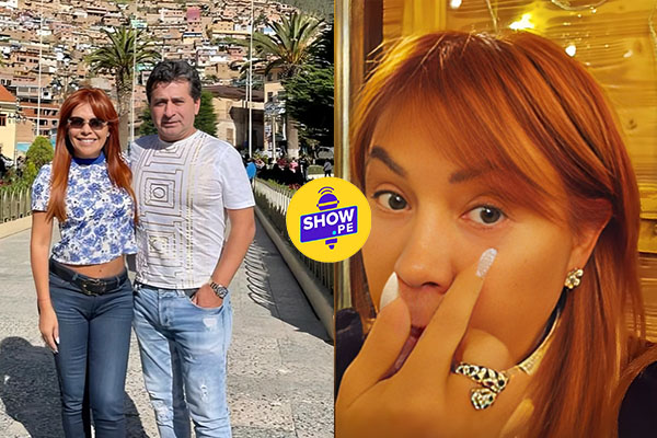 Magaly muestra su orzuelo y cuestiona a Alfredo Zambrano: ¿amor así me quieres?