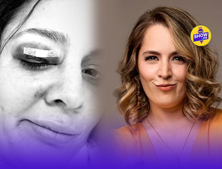 Yiddá Eslava preocupa a fans tras exponer una grave lesión en su rostro